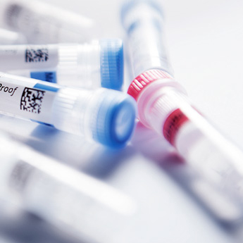 Enfeksiyon Hastalıkları